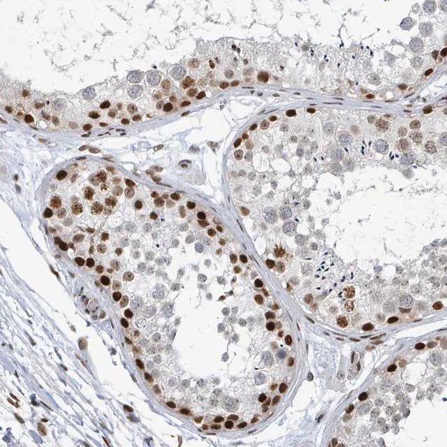 Anti-SUMO2 antibody produced in rabbit