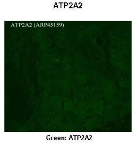 Anti-ATP2A2