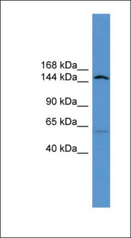 Anti-ATP10D antibody produced in rabbit