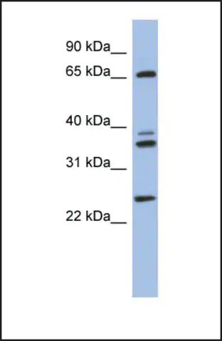 Anti-ATP6V1A, (N-terminal) antibody produced in rabbit