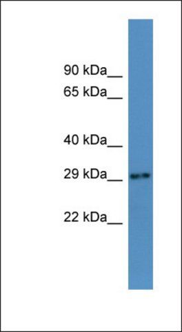 Anti-AUH antibody produced in rabbit