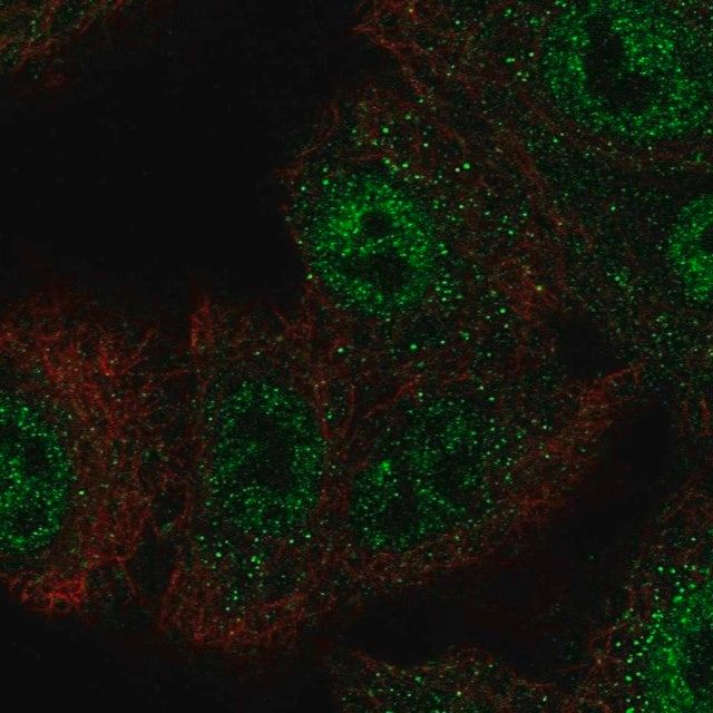 Anti-CIC antibody produced in rabbit