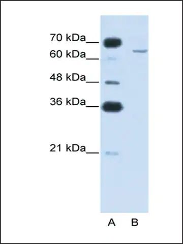 Anti-CPEB2 antibody produced in rabbit