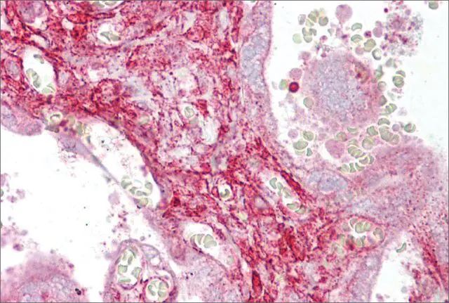 Anti-CALD1 antibody produced in rabbit