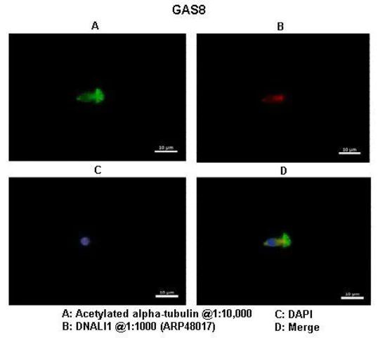 Anti-GAS8 antibody produced in rabbit